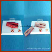 Atherosclerosis with Cross Section Model of Artery (2 part)